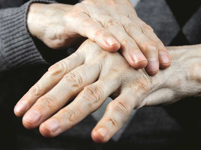 関節リウマチとは