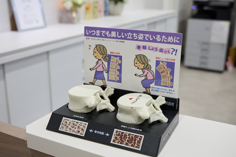 骨粗鬆症性骨折のリスクと予防